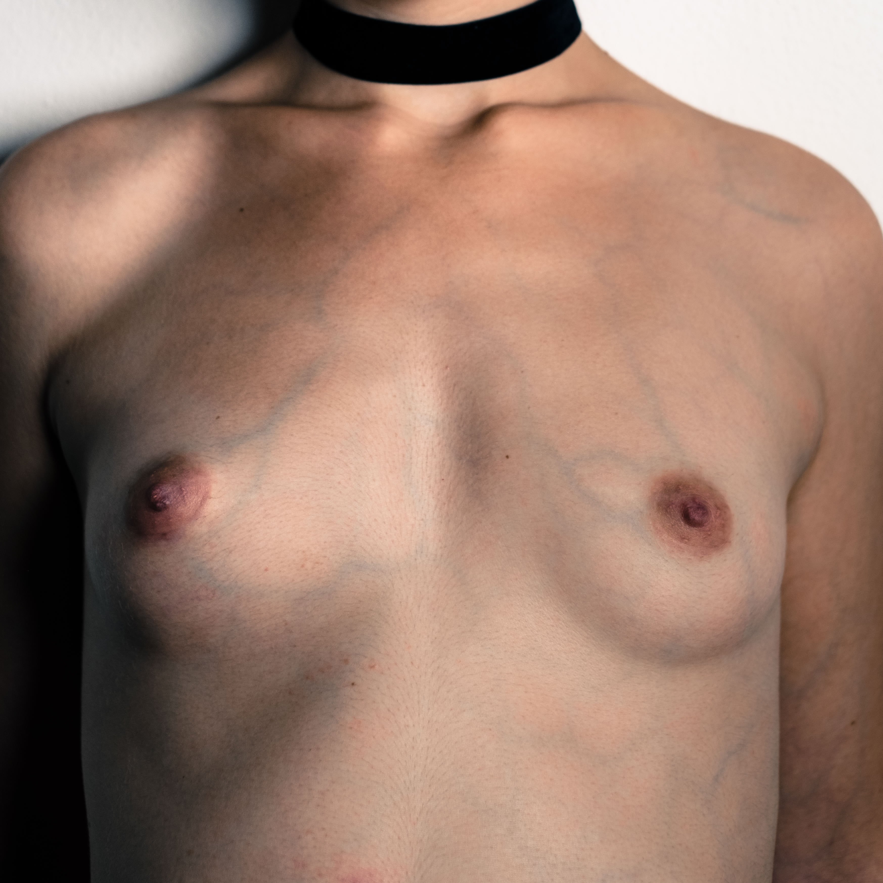 Torsо in bianco e nero ritratto in primo piano dal collo all'addome; il volto non è visibile nell'inquadratura; seni piccoli e nudi, vene superficiali ben visibili sul petto e sulle clavicole; un collarino scuro (choker) è avvolto attorno al collo; pelle chiara, luce laterale che evidenzia le vene e i contorni muscolari; sfondo neutro sfocato.